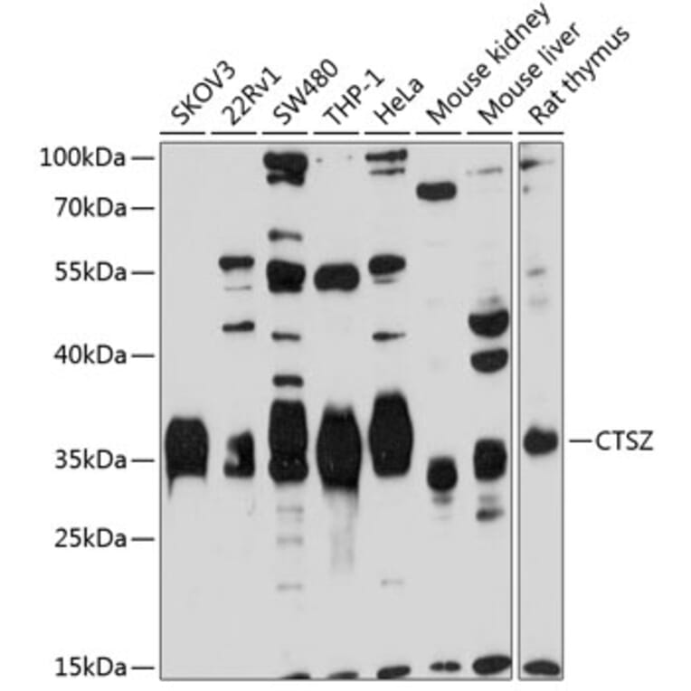 Western Blot - Anti-Cathepsin Z Antibody (A14132) - Antibodies.com