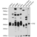 Western Blot - Anti-Cathepsin Z Antibody (A14132) - Antibodies.com