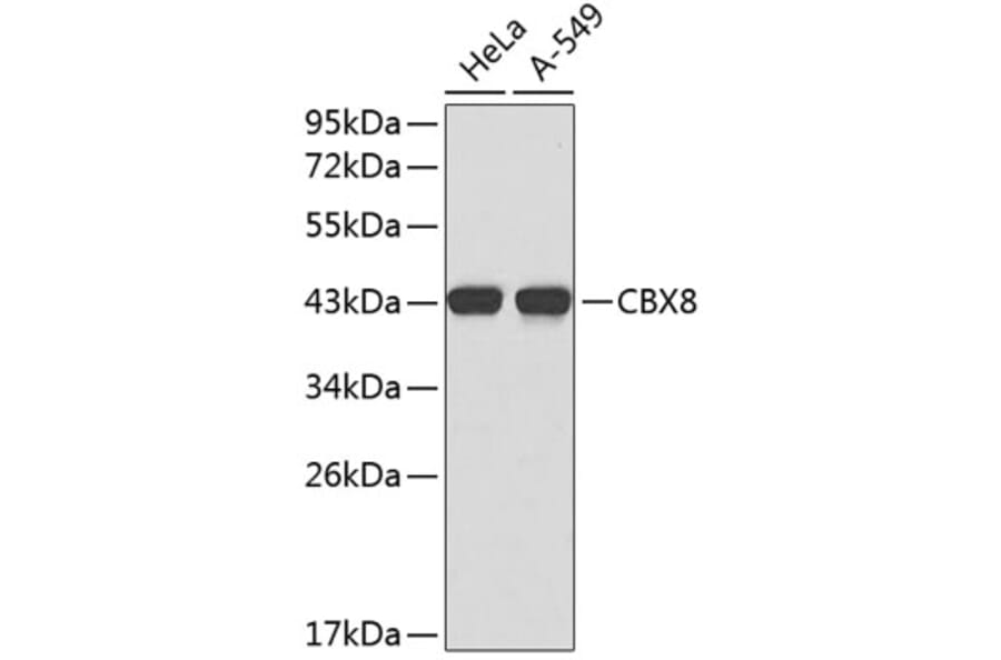 Western Blot - Anti-CBX8 Antibody (A2682) - Antibodies.com