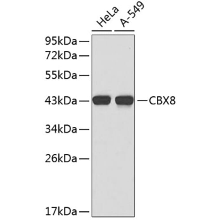 Western Blot - Anti-CBX8 Antibody (A2682) - Antibodies.com