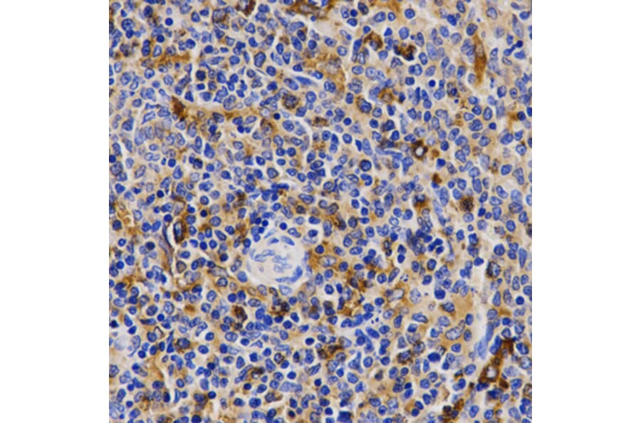 Immunohistochemistry - Anti-CDK20 Antibody (A2686) - Antibodies.com