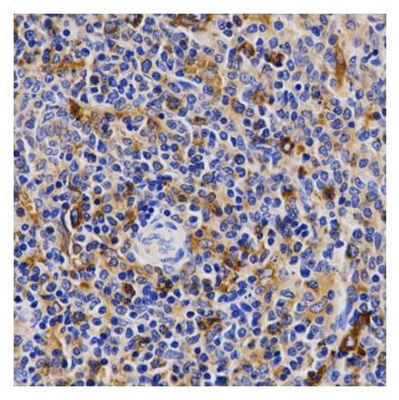 Immunohistochemistry - Anti-CDK20 Antibody (A2686) - Antibodies.com