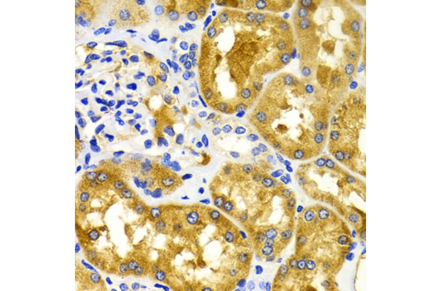 Immunohistochemistry - Anti-CDK20 Antibody (A2686) - Antibodies.com
