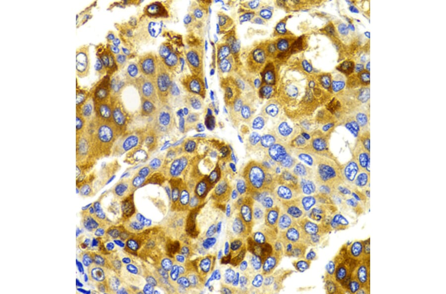 Immunohistochemistry - Anti-CDK20 Antibody (A2686) - Antibodies.com