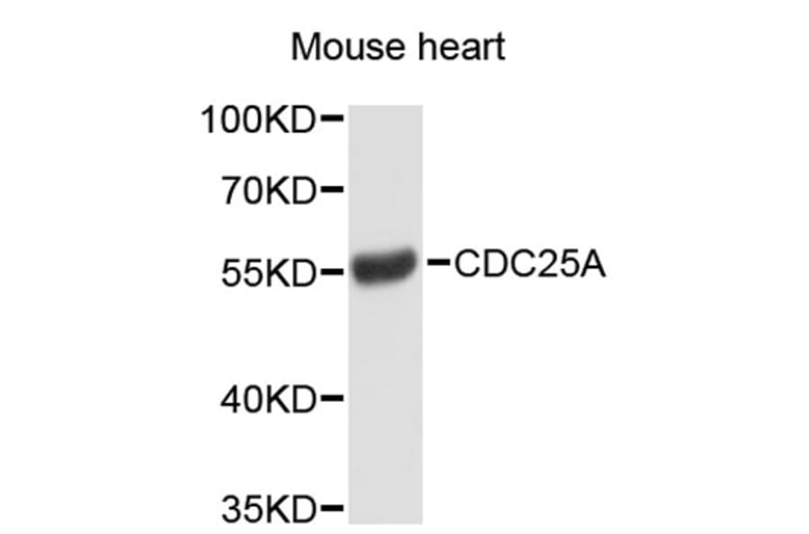 Western Blot - Anti-CDC25A Antibody (A2687) - Antibodies.com