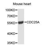 Western Blot - Anti-CDC25A Antibody (A2687) - Antibodies.com