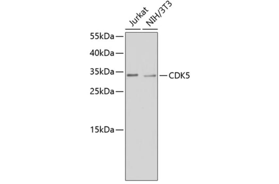 Western Blot - Anti-CDK5 Antibody (A14136) - Antibodies.com