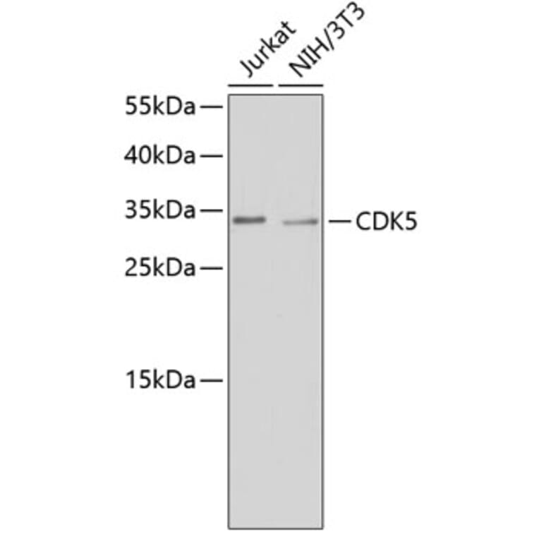 Western Blot - Anti-CDK5 Antibody (A14136) - Antibodies.com