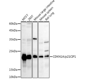 Western Blot - Anti-p21 Antibody (A14137) - Antibodies.com