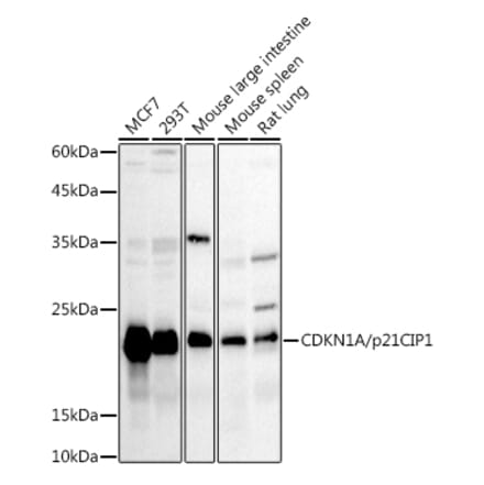 Western Blot - Anti-p21 Antibody (A14137) - Antibodies.com