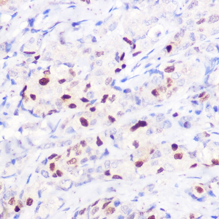 Immunohistochemistry - Anti-p21 Antibody (A14137) - Antibodies.com