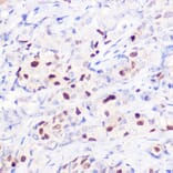 Immunohistochemistry - Anti-p21 Antibody (A14137) - Antibodies.com