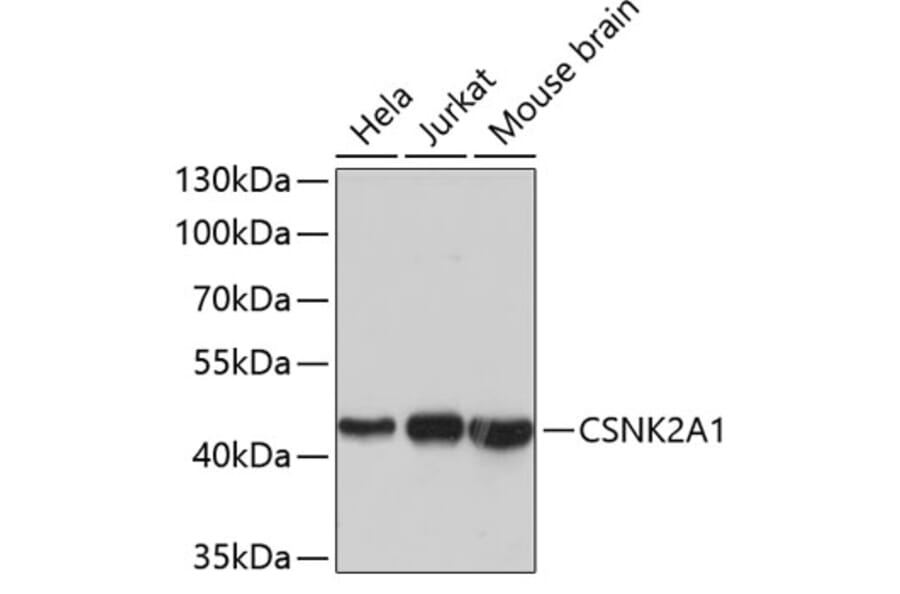 Western Blot - Anti-CSNK2A1 Antibody (A2694) - Antibodies.com