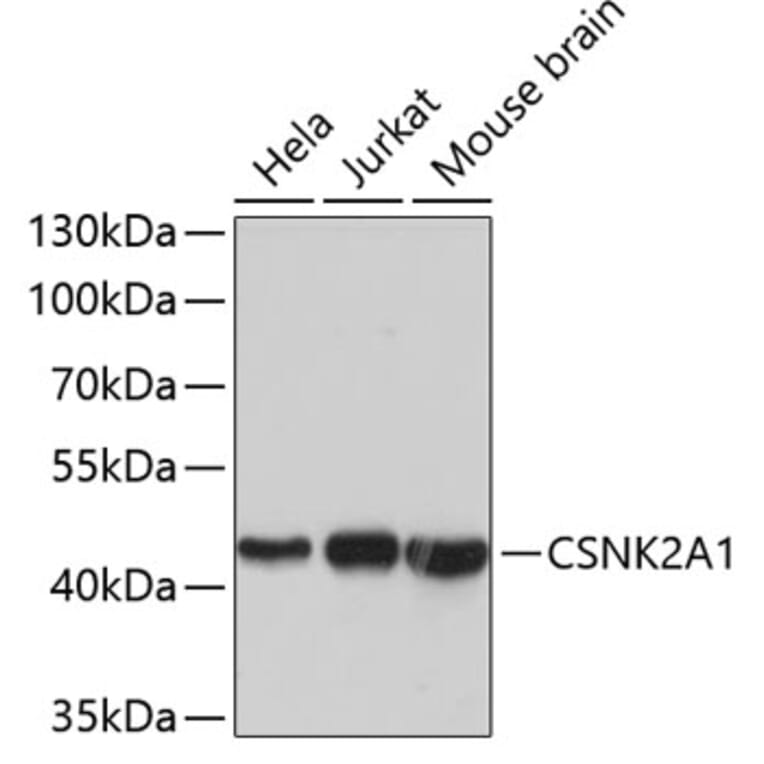 Western Blot - Anti-CSNK2A1 Antibody (A2694) - Antibodies.com