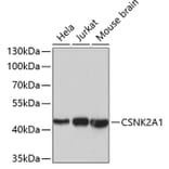 Western Blot - Anti-CSNK2A1 Antibody (A2694) - Antibodies.com