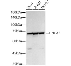 Western Blot - Anti-CNGA2 Antibody (A14140) - Antibodies.com