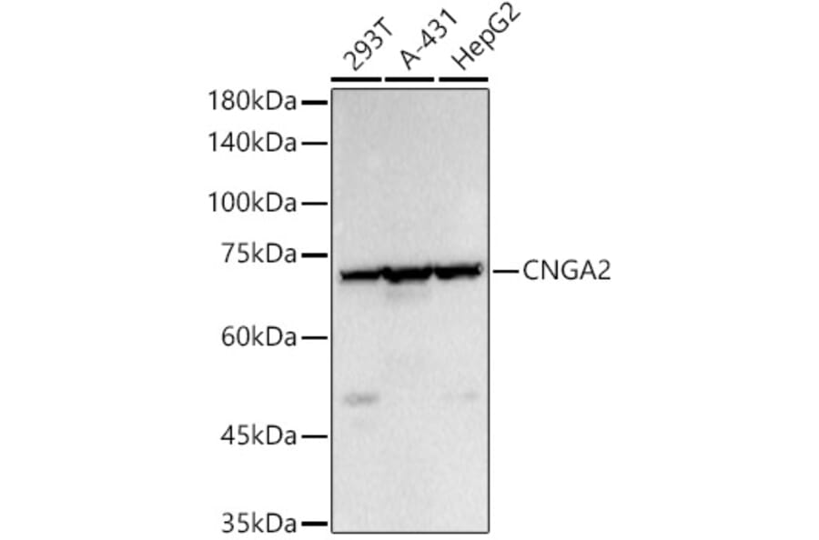 Western Blot - Anti-CNGA2 Antibody (A14140) - Antibodies.com