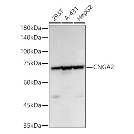 Western Blot - Anti-CNGA2 Antibody (A14140) - Antibodies.com
