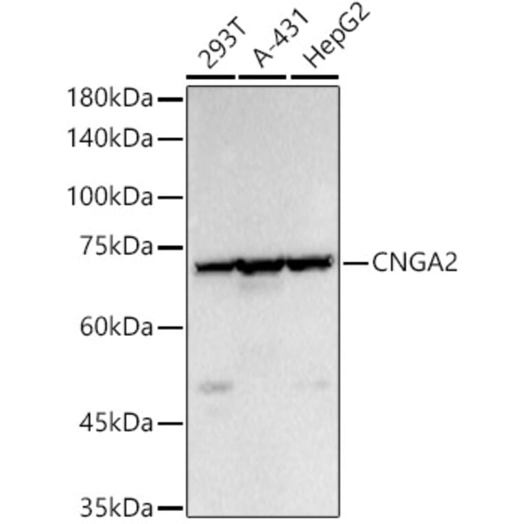 Western Blot - Anti-CNGA2 Antibody (A14140) - Antibodies.com