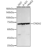 Western Blot - Anti-CNGA2 Antibody (A14140) - Antibodies.com