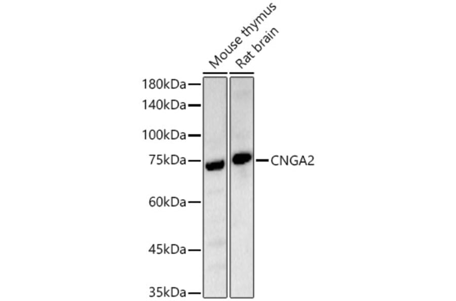 Western Blot - Anti-CNGA2 Antibody (A14140) - Antibodies.com