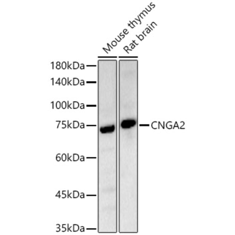 Western Blot - Anti-CNGA2 Antibody (A14140) - Antibodies.com