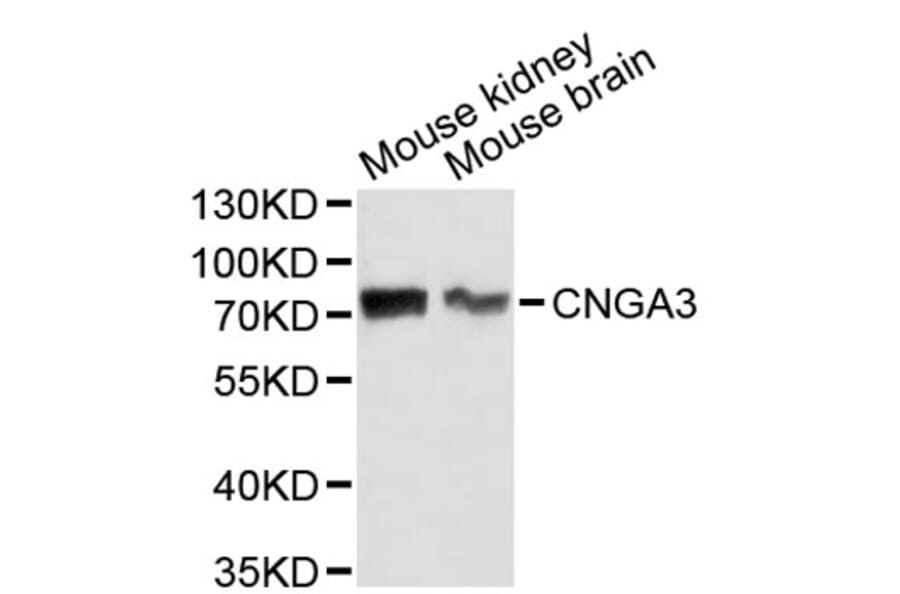 Western Blot - Anti-CNGA3 Antibody (A2699) - Antibodies.com