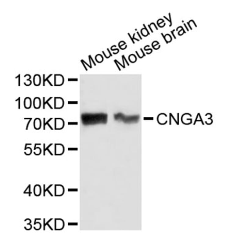 Western Blot - Anti-CNGA3 Antibody (A2699) - Antibodies.com