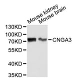 Western Blot - Anti-CNGA3 Antibody (A2699) - Antibodies.com