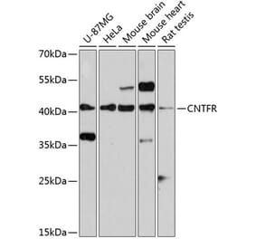 Western Blot - Anti-CNTFR Antibody (A14142) - Antibodies.com
