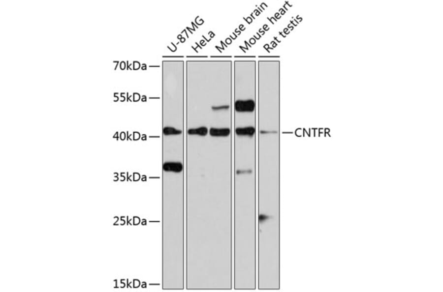 Western Blot - Anti-CNTFR Antibody (A14142) - Antibodies.com