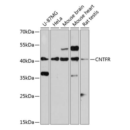 Western Blot - Anti-CNTFR Antibody (A14142) - Antibodies.com