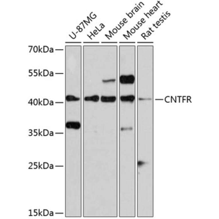 Western Blot - Anti-CNTFR Antibody (A14142) - Antibodies.com