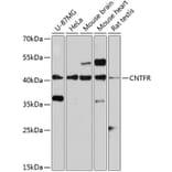 Western Blot - Anti-CNTFR Antibody (A14142) - Antibodies.com