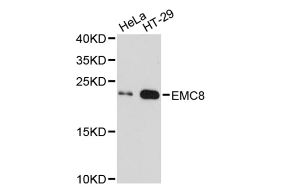 Western Blot - Anti-EMC8 Antibody (A2701) - Antibodies.com