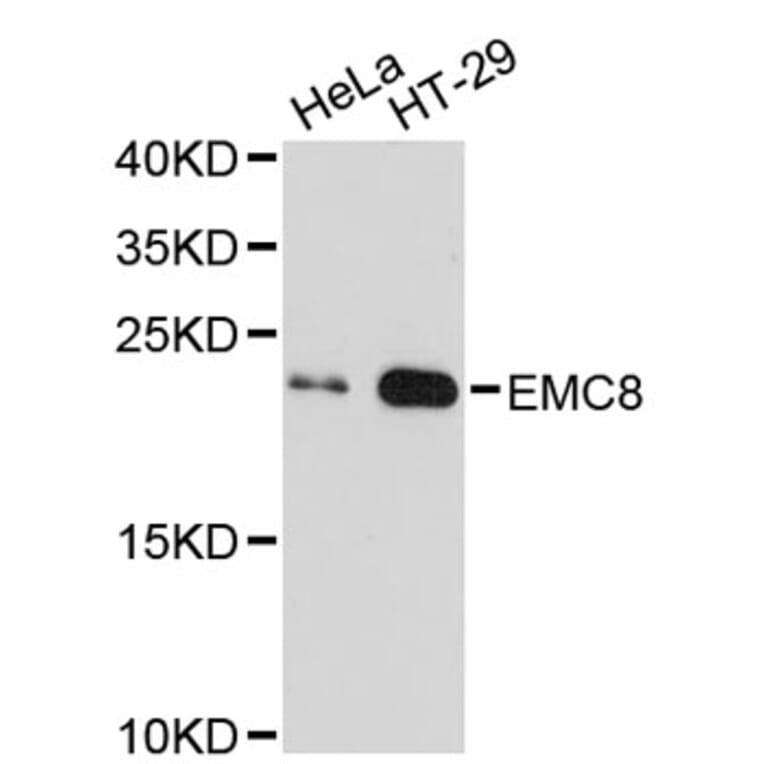 Western Blot - Anti-EMC8 Antibody (A2701) - Antibodies.com