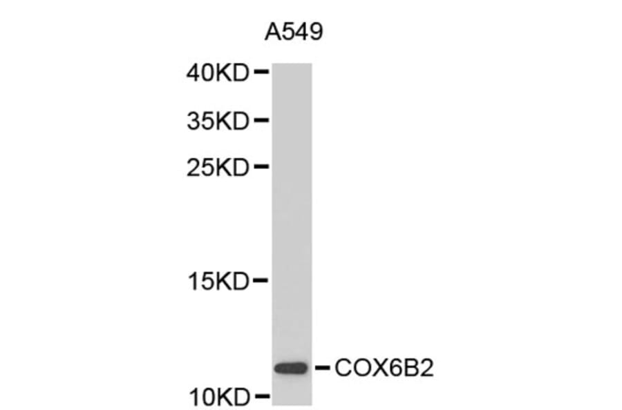 Western Blot - Anti-COX6B2 Antibody (A2702) - Antibodies.com