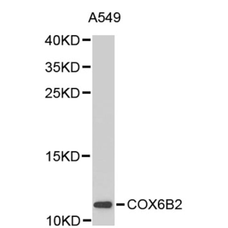 Western Blot - Anti-COX6B2 Antibody (A2702) - Antibodies.com