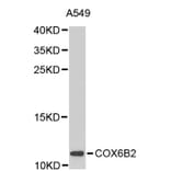 Western Blot - Anti-COX6B2 Antibody (A2702) - Antibodies.com