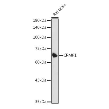Western Blot - Anti-CRMP1 Antibody (A14145) - Antibodies.com