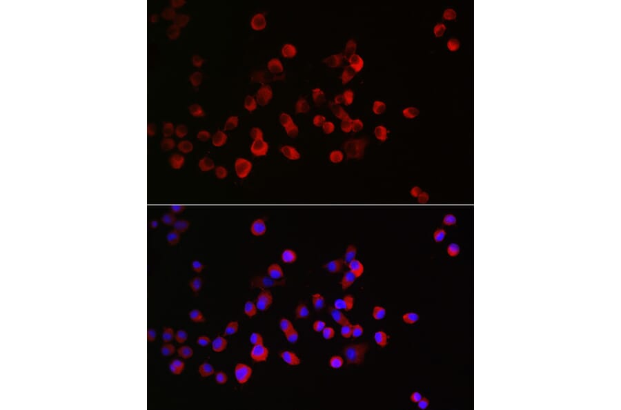 Immunofluorescence - Anti-CRMP1 Antibody (A14145) - Antibodies.com