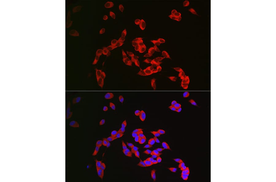 Immunofluorescence - Anti-CRMP1 Antibody (A14145) - Antibodies.com