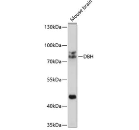 Western Blot - Anti-Dopamine beta Hydroxylase Antibody (A14146) - Antibodies.com