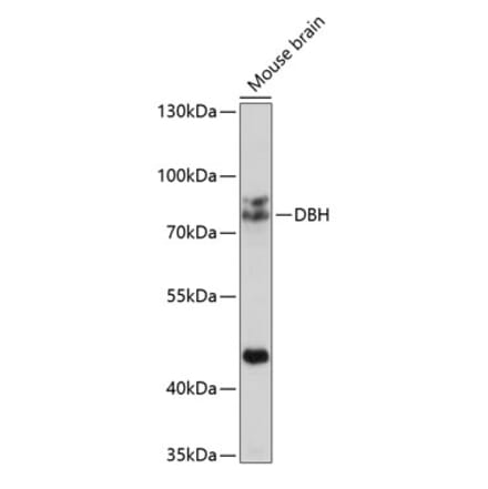 Western Blot - Anti-Dopamine beta Hydroxylase Antibody (A14146) - Antibodies.com