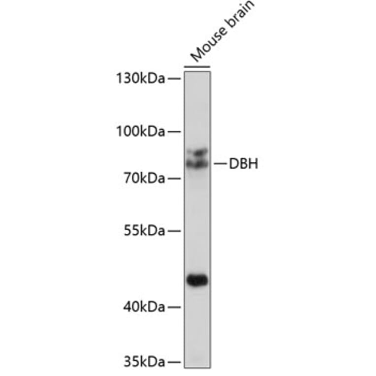 Western Blot - Anti-Dopamine beta Hydroxylase Antibody (A14146) - Antibodies.com