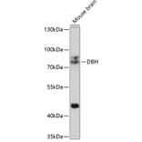 Western Blot - Anti-Dopamine beta Hydroxylase Antibody (A14146) - Antibodies.com