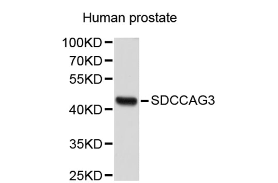 Western Blot - Anti-SDCCAG3 Antibody (A2712) - Antibodies.com