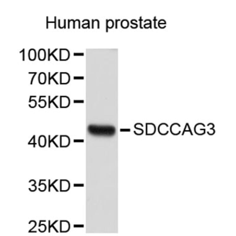 Western Blot - Anti-SDCCAG3 Antibody (A2712) - Antibodies.com
