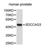 Western Blot - Anti-SDCCAG3 Antibody (A2712) - Antibodies.com