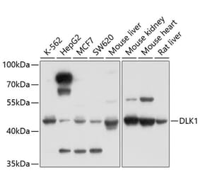 Western Blot - Anti-DLK-1 Antibody (A14149) - Antibodies.com
